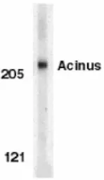 Anti-Acinus antibody used in Western Blot (WB). GTX27354