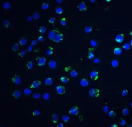 Anti-Acinus antibody used in Immunocytochemistry/ Immunofluorescence (ICC/IF). GTX27354