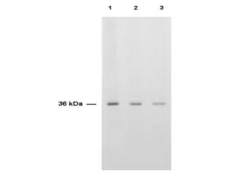 Anti-Thymidylate synthase antibody used in Western Blot (WB). GTX27398