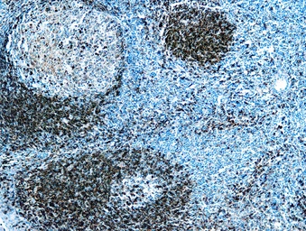 Anti-CD79a antibody [HM47/A9] (ready-to-use) used in IHC (Paraffin sections) (IHC-P). GTX27491