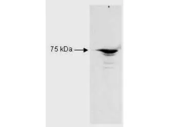 Anti-RFX5 antibody used in Western Blot (WB). GTX27542