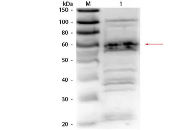 Anti-RFX5 antibody used in Western Blot (WB). GTX27542