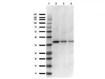 Anti-IKB beta antibody used in Western Blot (WB). GTX27547