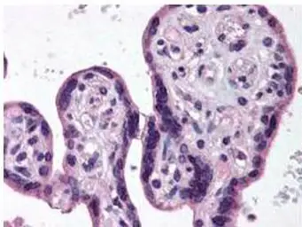 Anti-IKK beta antibody used in IHC (Paraffin sections) (IHC-P). GTX27611