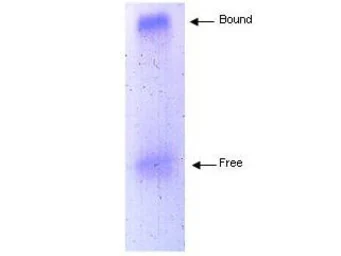 Anti-Apolipoprotein A1 antibody used in  (). GTX27613