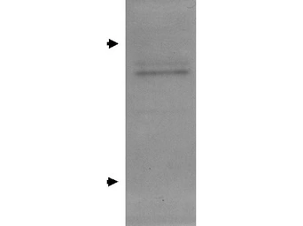 Anti-Apolipoprotein E antibody used in Western Blot (WB). GTX27620