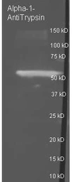 Anti-alpha 1 Antitrypsin antibody used in Western Blot (WB). GTX27633
