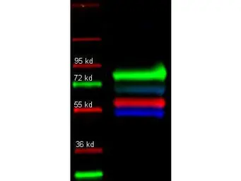 Anti-alpha 1 Antitrypsin antibody used in Western Blot (WB). GTX27633