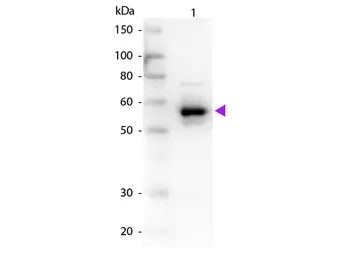 Anti-alpha 1 Antitrypsin antibody used in Western Blot (WB). GTX27633