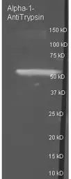 Anti-alpha 1 Antitrypsin antibody used in Western Blot (WB). GTX27633