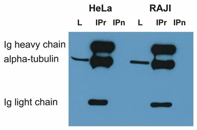 Anti-alpha Tubulin antibody [TU-16] used in Immunoprecipitation (IP). GTX27749