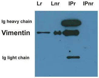 Anti-Vimentin antibody [VI-01] used in Western Blot (WB). GTX27752