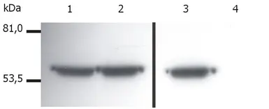 Anti-Vimentin antibody [VI-01] used in Western Blot (WB). GTX27752