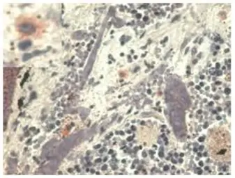 Anti-HLA-G antibody [MEM-G/1] used in IHC (Paraffin sections) (IHC-P). GTX27759