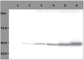 Anti-beta Tubulin antibody [TU-06] used in Western Blot (WB). GTX27792