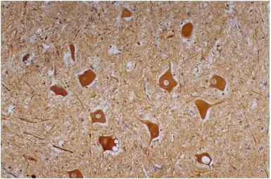 Anti-NF-H antibody [NF-01] used in IHC (Paraffin sections) (IHC-P). GTX27795