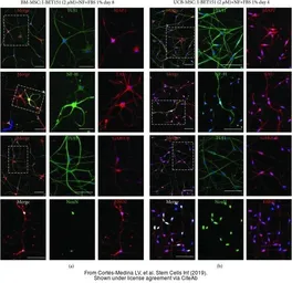 Anti-NF-H antibody [NF-01] used in Immunocytochemistry/ Immunofluorescence (ICC/IF). GTX27795