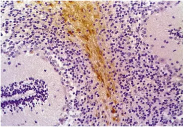 Anti-GFAP antibody [GF-01] used in IHC (Paraffin sections) (IHC-P). GTX27806