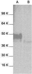Anti-JNK1 antibody used in Western Blot (WB). GTX27949