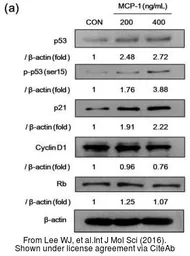 Anti-p21 Cip1 antibody used in Western Blot (WB). GTX27960
