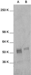 Anti-c-Fos antibody used in Western Blot (WB). GTX27963