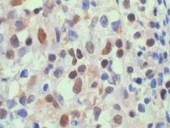 Anti-NFkB p65 antibody used in IHC (Paraffin sections) (IHC-P). GTX27970
