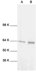 Anti-NFkB p65 antibody used in Western Blot (WB). GTX27970