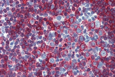 Anti-HLA-DR + HLA-DP antibody [MEM-136] used in IHC (Paraffin sections) (IHC-P). GTX28094