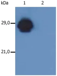 Anti-HLA-DR + HLA-DP antibody [MEM-136] used in Western Blot (WB). GTX28094