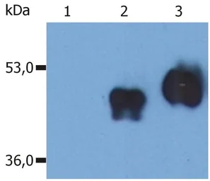 Anti-CD14 antibody [MEM-18] used in Western Blot (WB). GTX28103