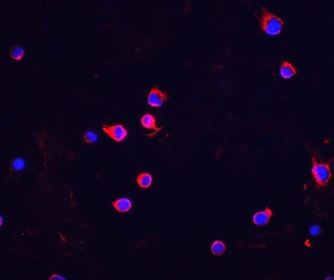 Anti-Chk2 antibody used in Immunocytochemistry/ Immunofluorescence (ICC/IF). GTX28108
