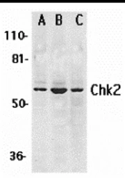 Anti-Chk2 antibody used in Western Blot (WB). GTX28108