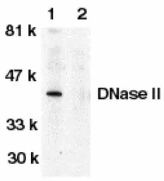 Anti-DNase II antibody used in Western Blot (WB). GTX28119