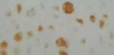 Anti-Neurofibromin antibody used in IHC (Paraffin sections) (IHC-P). GTX28132