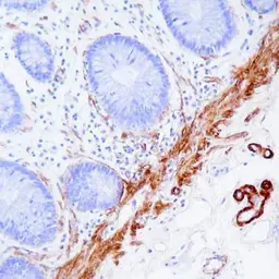 Primary Antibody Diluent. GTX28208