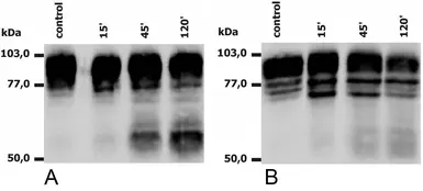 Anti-CD18 antibody [MEM-148] used in Western Blot (WB). GTX28220