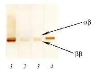 Anti-S100 antibody [8B10] used in Western Blot (WB). GTX28330