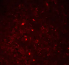 Anti-TMS1 antibody used in IHC (Paraffin sections) (IHC-P). GTX28394
