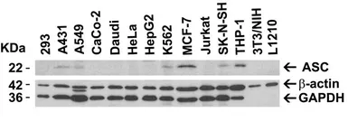 Anti-TMS1 antibody used in Western Blot (WB). GTX28394