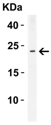 Anti-TMS1 antibody used in Western Blot (WB). GTX28394