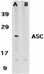 Anti-TMS1 antibody used in Western Blot (WB). GTX28394