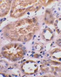 Anti-BNIP3L antibody used in IHC (Paraffin sections) (IHC-P). GTX28399