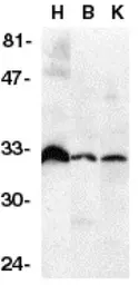 Anti-DcR3 antibody used in Western Blot (WB). GTX28405