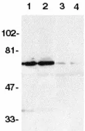 Anti-DR6 antibody used in Western Blot (WB). GTX28417