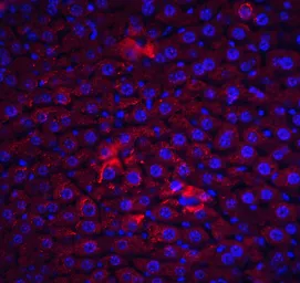Anti-FLIP antibody used in IHC (Paraffin sections) (IHC-P). GTX28421