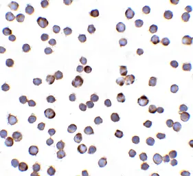 Anti-RAIDD antibody, C-term used in Immunocytochemistry/ Immunofluorescence (ICC/IF). GTX28425