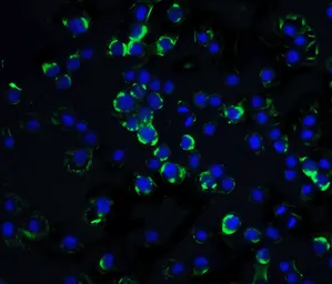 Anti-RAIDD antibody, C-term used in Immunocytochemistry/ Immunofluorescence (ICC/IF). GTX28425