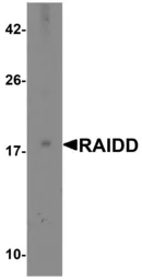 Anti-RAIDD antibody, C-term used in Western Blot (WB). GTX28425