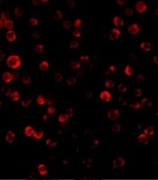 Anti-RAIDD antibody used in Immunocytochemistry/ Immunofluorescence (ICC/IF). GTX28426