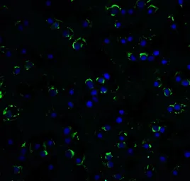Anti-RAIDD antibody used in Immunocytochemistry/ Immunofluorescence (ICC/IF). GTX28426